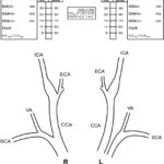 Carotid Ultrasound Report Template