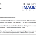 Knee X Ray Report Template