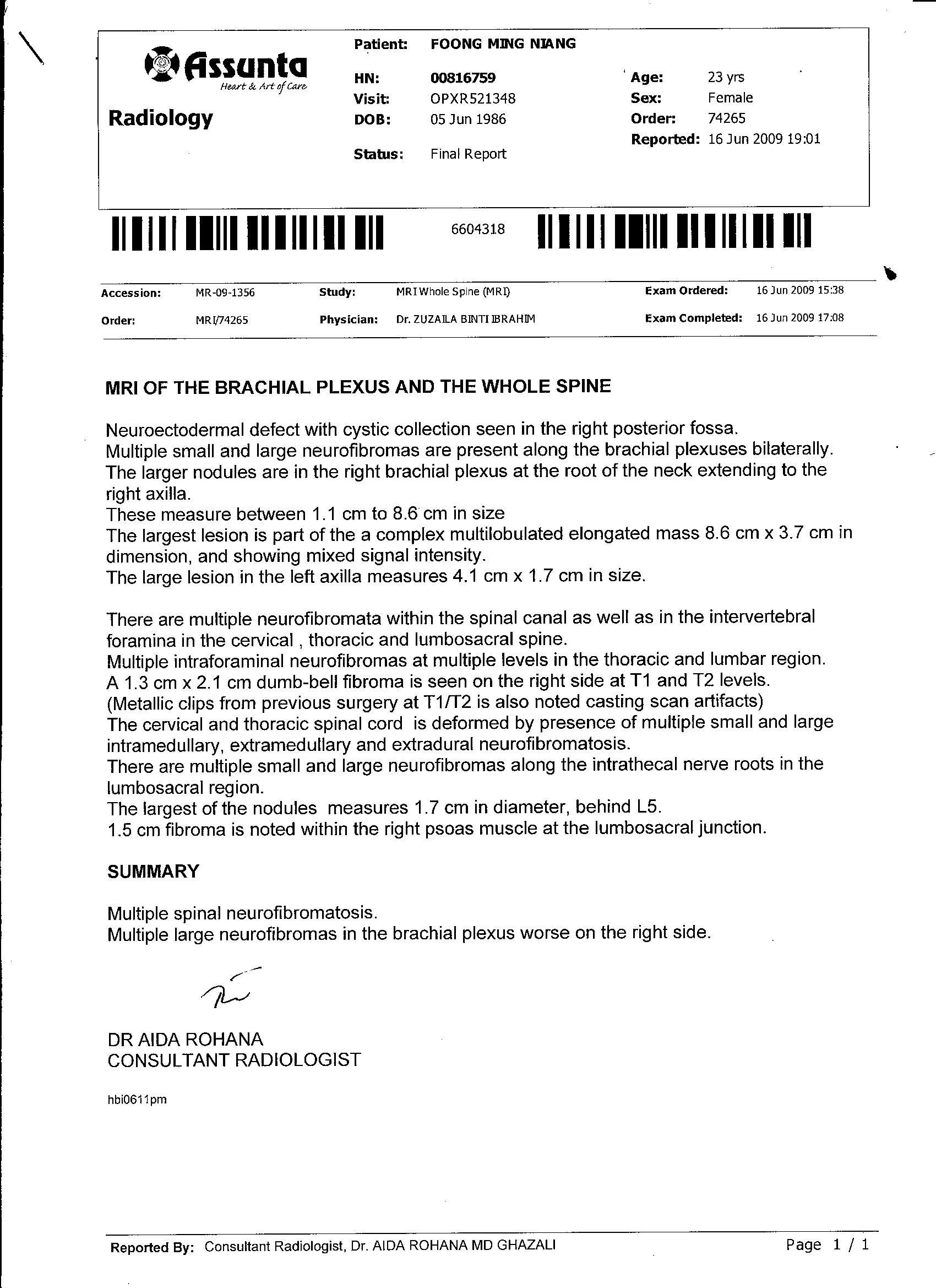 Lumbar X Ray Report Template